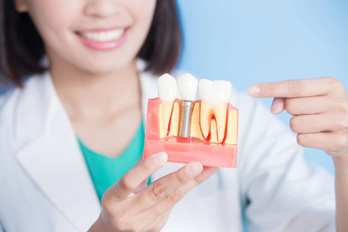 Dental implant guides and treatment information