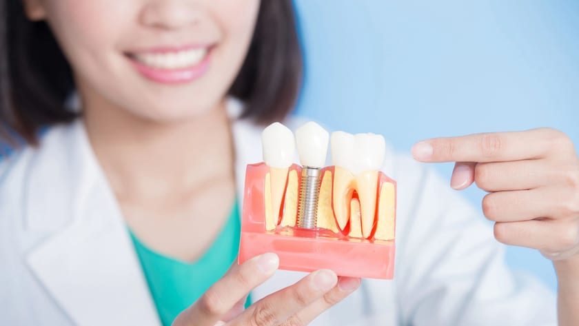 Dentist presenting a jaw model fitted with dental implants